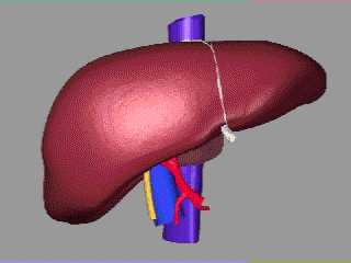 Tecnica di split liver modificato nel trapianto di fegato